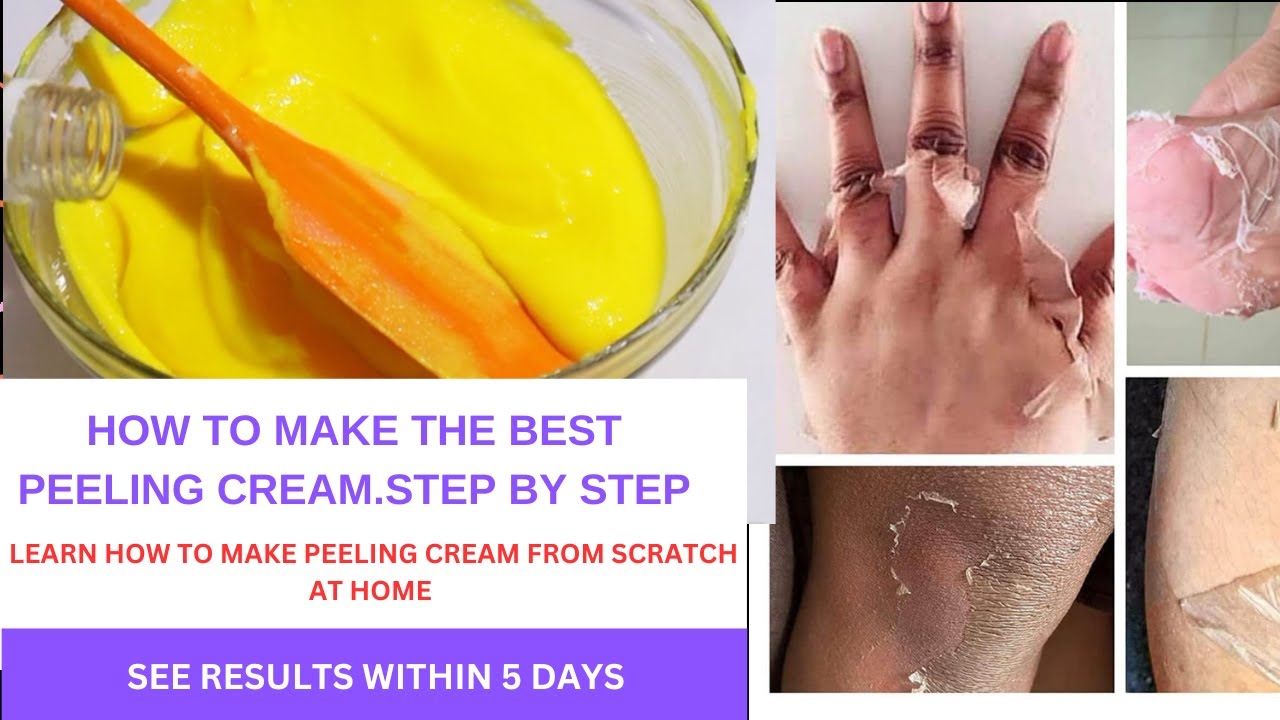 HOW TO MAKE DARK KNUCKLES PEELING CREAM skincare peelingcream beauty