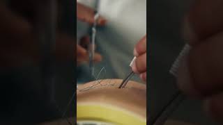 Master Suturing Basics With Expert Tutorials