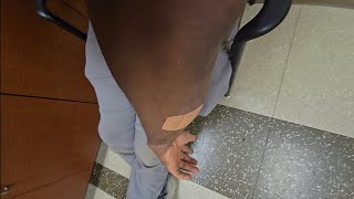 I fell down a flight of stairs I thought my arm was broken!