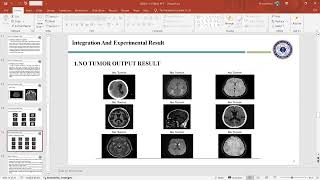 BRAIN TUMOR DETECTION USING IMAGE PROCESSING WITH PYTHIN AND SCIKIT LEARN