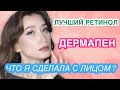 ДЕРМАПЕН, ЛУЧШИЙ РЕТИНОЛ, СКОЛЬКО ПИТЬ ВОДЫ || ВАШИ ВОПРОСЫ