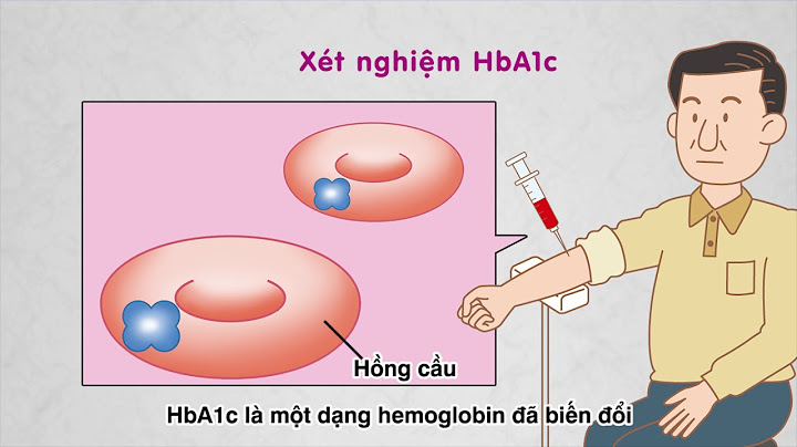 Chi tiêu iv trong kiểm nghiệm mỡ bò là gì năm 2024