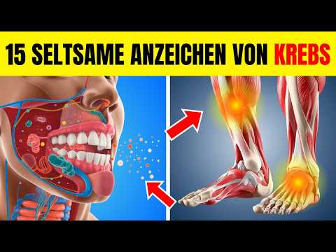 ACHTUNG! 15 Frühe
