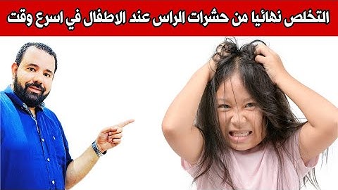 التخلص من حشرات الشعر (القمل) عند الاطفال نهائيا في يوم واحد