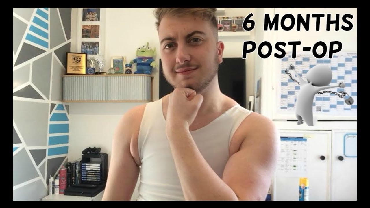 FTM 6 Months PostOp Top Surgery & Binding Again YouTube