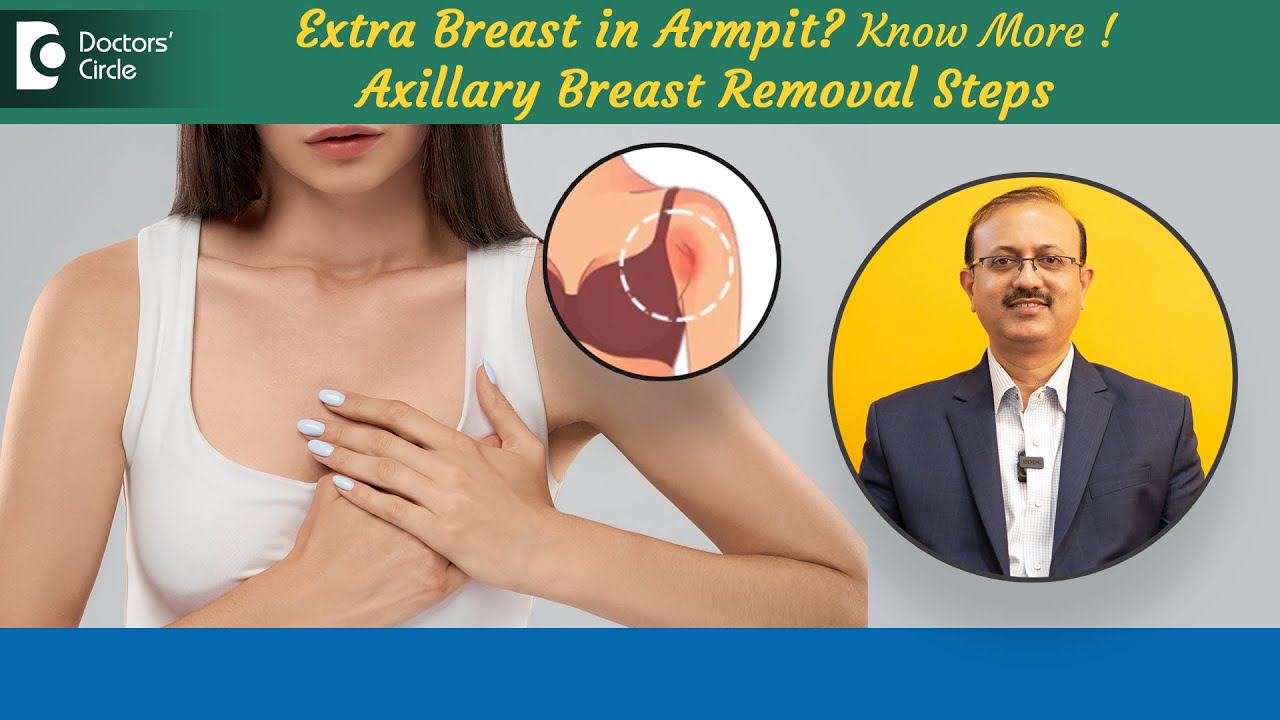 extra-breast-tissue-in-armpit-axillary-breast-removal-procedure-dr