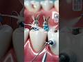 Tiny Rabbit Dentists Flossing Giant Human Teeth | Incredible Macro Dental Cleaning