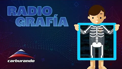 Radiografa | Franco Vivian desde adentro