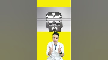 Cách gắn mắc cài kim loại tự buộc để giảm thời gian niềng răng #nhakhoa #bacsidieutaithu #niengrang