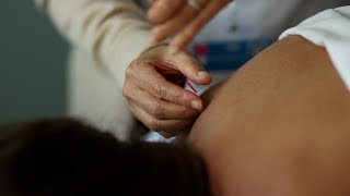 Can acupuncture balance hormones?