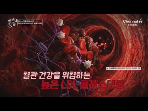 [Preview] A Warning Sign Shaking Up Daily Life!? High LDL Cholesterol Threatening Vascular Health...