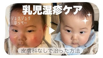 乳児湿疹 Youtube