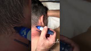 CERVICALGIA PERSISTENTE, DOLOR DE CABEZA.