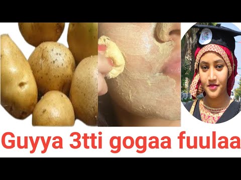 Guyyaa 3 Kessati Fuula Keenya Barechuuf Removing Dark Spot On Face In 3 Days