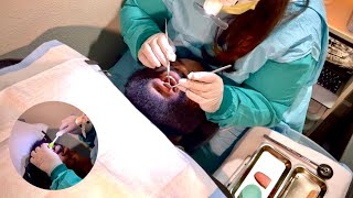 ASMR - Real Person Dental Exam (Check up & Cleaning) Teeth TAPPING/SCRAPING, Real Suction Sounds