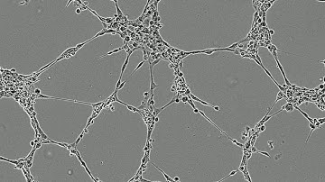 Formation of lumens by endothelial cells in vitro
