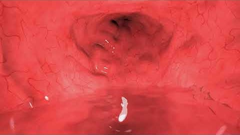 Ambient Gurgles - Ultimate Sleep Audio