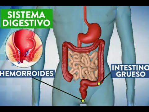 Video: ¿Por qué hay fugas en mis almorranas?