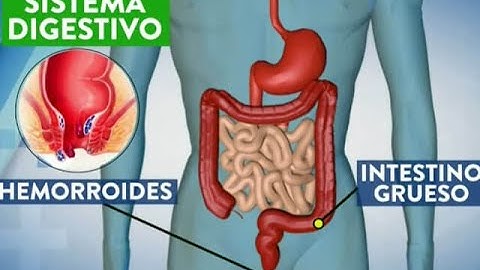 Hemorroides, ¿qué son, por qué salen y cómo curarlas?