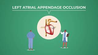 Left Atrial Appendage Occlusion (LAAO): A Life-Saving Alternative for AFib Patients