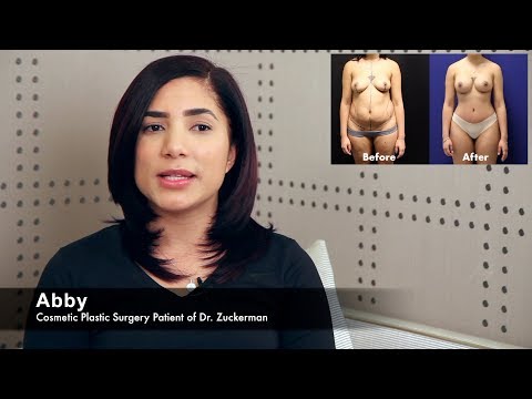 Mommy Makeover NY - Plastic Surgery After Pregnancy