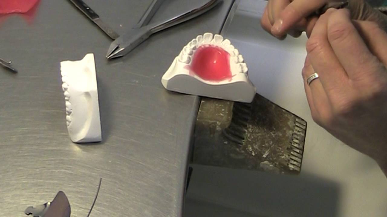 Apparecchio funzionale parte 1 su 11