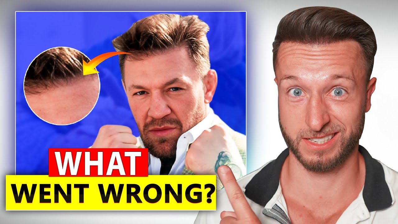 Conor McGregor's Hair Transplant Failed - Here's Why