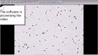 MMC Sperm: sperm motility analysis in bright field