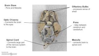 Sheep Brain Dissection Lab