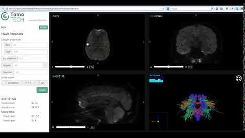 TomoTECH DTI Software