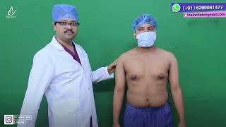 Gynecomastia Marking | Male Breast Reduction Surgery in Kolkata | Dr. Jayanta Bain