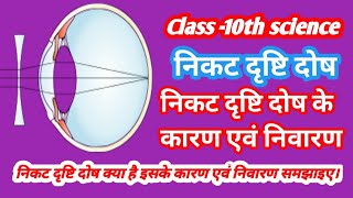 निकट दृष्टि दोष कक्षा 10  | nikat drishti dosh class 10 | near/short sightedness | myopia