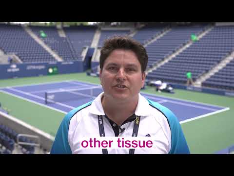 Fracture vs. Broken Bone