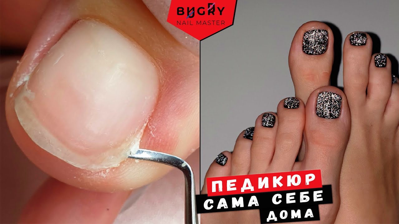 КАКИЕ ПРОБЛЕМЫ В ПЕДИКЮРЕ / САМА СЕБЕ #ТатьянаБугрий
