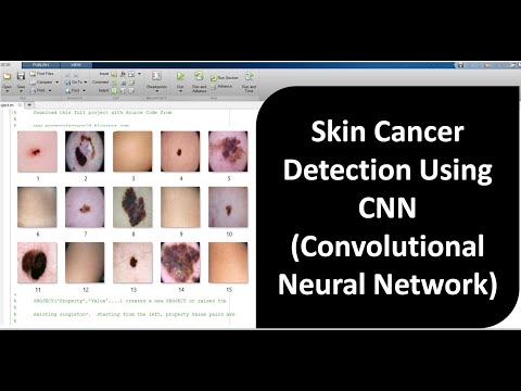 Skin Cancer Detection Using CNN | Skin Cancer Classification Using Matlab | Skin Cancer Prediction