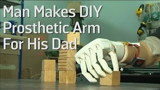 Man Makes DIY Prosthetic Arm For His Dad