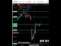 Gold Price Action Update XAU/USD Daily Analysis 📊 | #trading #bestgoldforexsignals #tradesetup