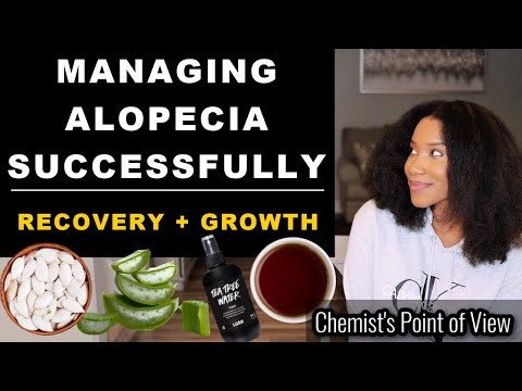 MANAGING ALOPECIA SUCCESSFULLY