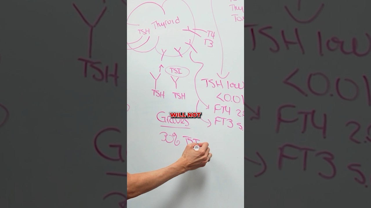 🤔 Unraveling the mystery of hyperthyroidism! 