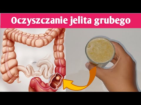 Wideo: 3 sposoby na oczyszczenie jelita grubego