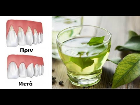 Βίντεο: 4 τρόποι χρήσης του λαδιού γαρύφαλλου για τον πόνο των δοντιών