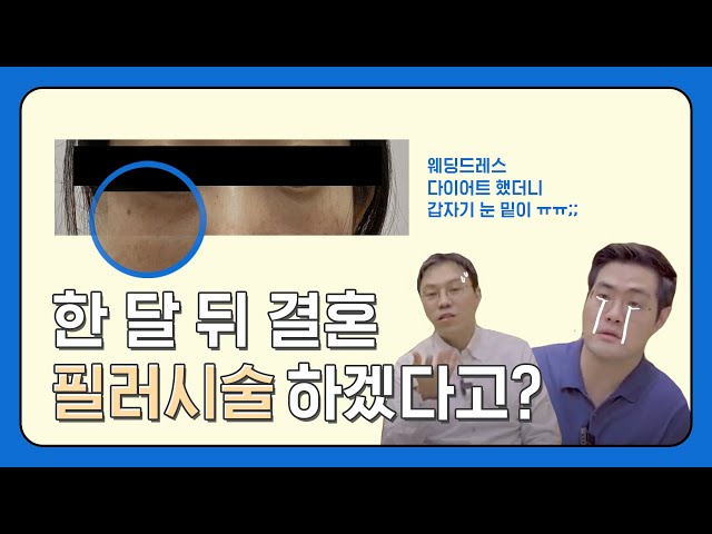 힘들게 #다이어트 성공했는데 눈 밑 피부가 꺼지고 까매졌어요... 저 한달 뒤에 결혼인데 어떻게 해요?