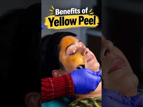 Want Brighter-Looking Skin? Yellow Peel & Carbon Peel Benefits #skin #shorts #ytshorts