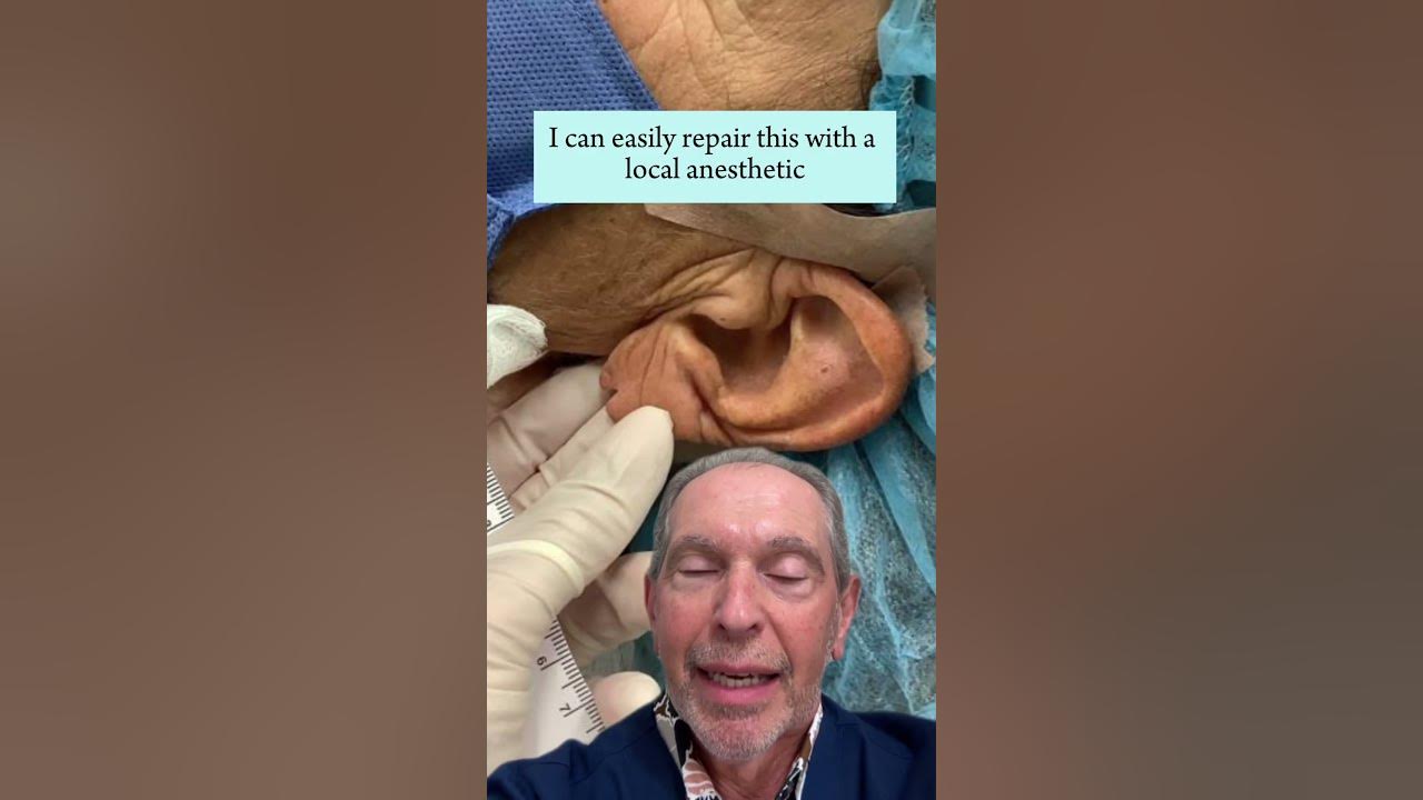 Earlobe Repair - Feinstein Dermatology & Cosmetic Surgery