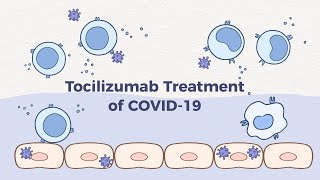 Tocilizumab Treatment of COVID-19