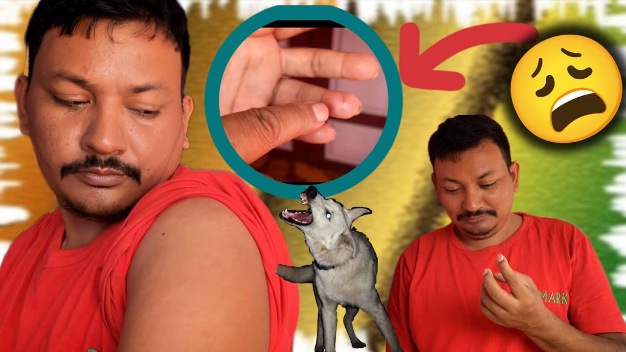 அந்த நாய் இப்படிச் செய்வதுனு எதிர்பாக்கல 😬 Dog attack பன்னிருச்சி 😩😩😩😩