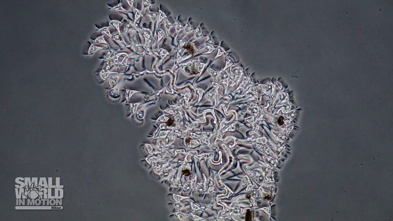 Zoothamnium Pelagicum Marine Ciliate | 2018 Nikon Small World