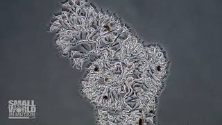 Zoothamnium Pelagicum Marine Ciliate | 2018 Nikon Small World
