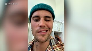 Justin Bieber says he has facial paralysis due to Ramsay Hunt syndrome l ABC7