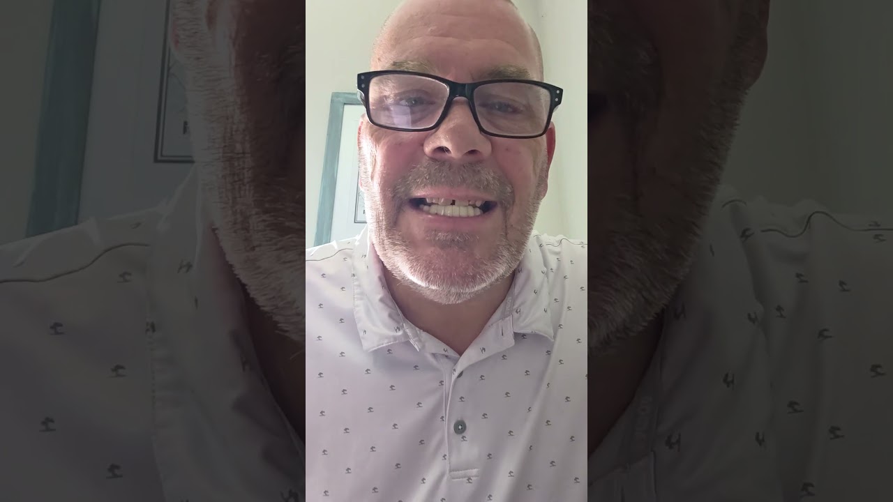 Shiny Smile Veneers review